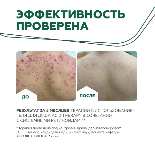 ГЕЛЬТЕК body Гель для душа Acid Therapy, 240мл, GELTEK