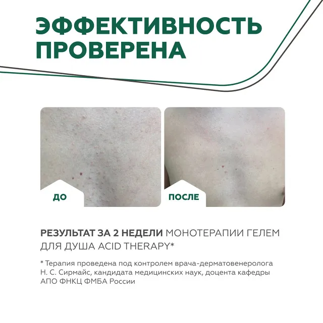 ГЕЛЬТЕК body Гель для душа Acid Therapy, 240мл, GELTEK