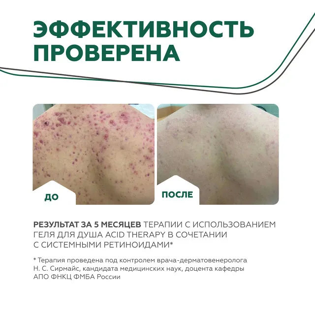 ГЕЛЬТЕК body Гель для душа Acid Therapy, 390мл, GELTEK