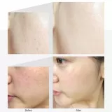 MEDI-PEEL Tranex Toning 9 Эссенция для лица против пигментации| 50мл | Tranex Toning 9